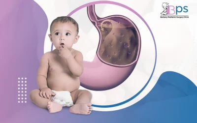 علاج ارتجاع المريء عند الرضع الناتج عن فتق الحجاب الحاجز